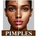How-To-Remove-Pimples-Open-pores-and Dark-Spots-At-Home.webp